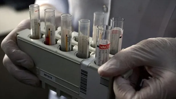 Hepatit B (Sarılık) nedir? Belirtileri nelerdir? Hepatit B nasıl tedavi edilir?-1