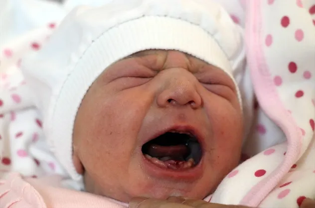 Amasya'da dokuz dişli bebek dünyaya geldi