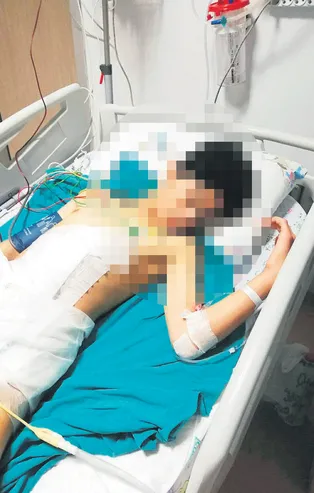 Çorumda başı boş köpekler tarafından saldırıya uğrayan çocuğun dalağı ve böbreği parçalandı