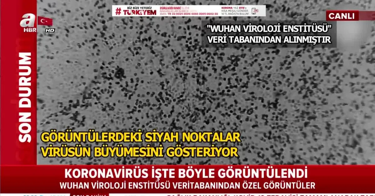 Wuhan Viroloji Enstitüsü dünyaya duyurdu: İşte Kovid-19 virüsünün en net görüntüsü!
