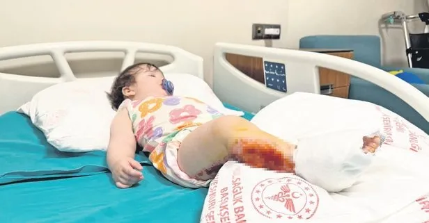 Çaydanlık kabusu! 1 yaşındaki Defne Mila’nın üstüne kaynar çaydanlığın demliği döküldü