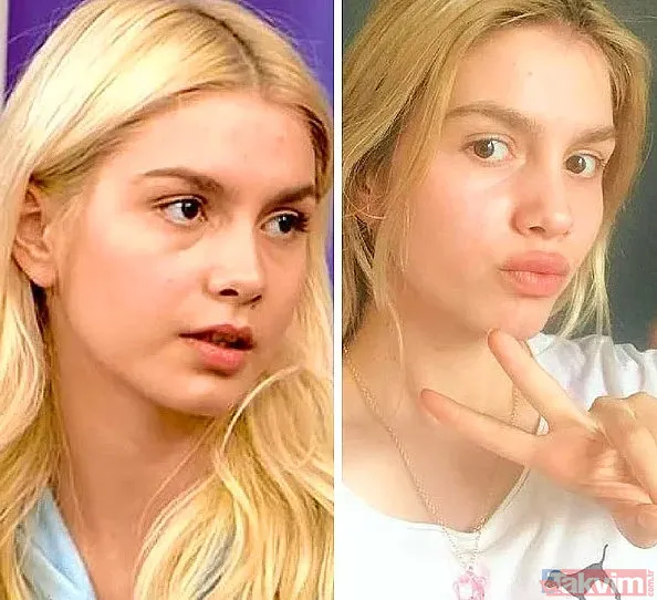 Aleyna Tilki’nin şiş dudakları olay oldu! Son halini gören dönüp bir daha baktı “Ajda Pekkan olma yolunda” - 32