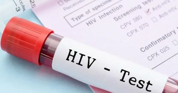 Karabük Üniversitesi’nde ne oldu? Afrikalı öğrenciler Türk öğrencilere HIV ve HPV mi bulaştırdı? Resmi açıklama geldi