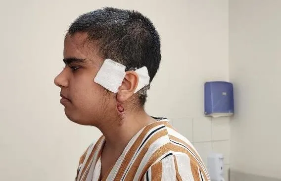 antalyada-go-kart-faciasi-saci-tekerlege-dolaninca-kafa-derisi-yerinden-siyrildi-1694360058702.jpeg Antalya'da Go-kart faciası! Saçı tekerleğe dolanınca kafa derisi yerinden sıyrıldı: Genç kız ölümden döndü-5