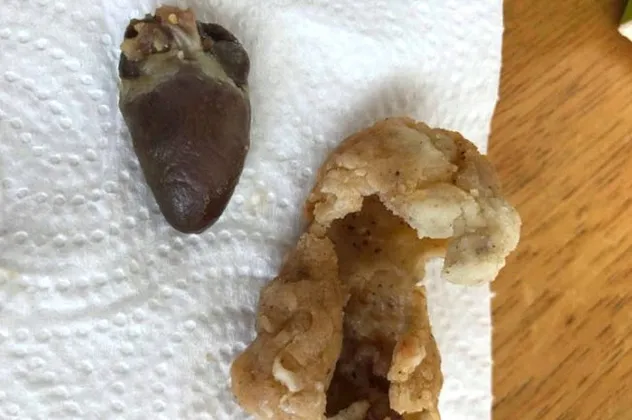 Fast-food zincirinden aldığı tavuktan çiğ kalp çıktı
