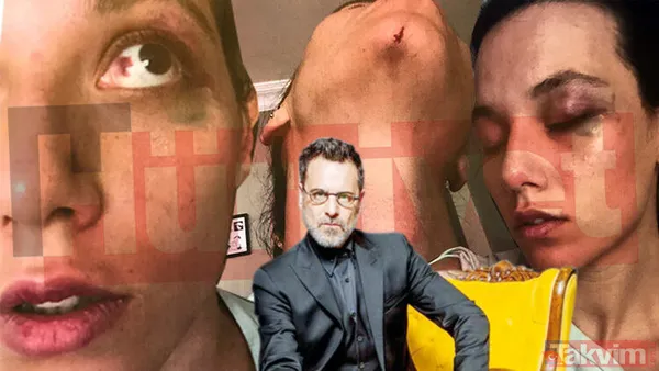 Ozan Güven - Deniz Bulutsuz Aşkı Yaklaşık 6 Ay Sonrta Olaylı Bir Şekilde Son Buldu. Agresif Tavırları İle Tanınan Oyuncu Ozan Güven'in, Sevgilisi Deniz...