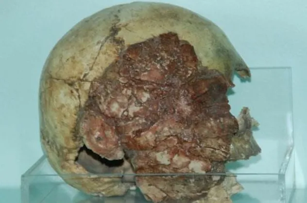 Niğde Müzesi'ndeki tarihi kafatası ilgi odağı oldu