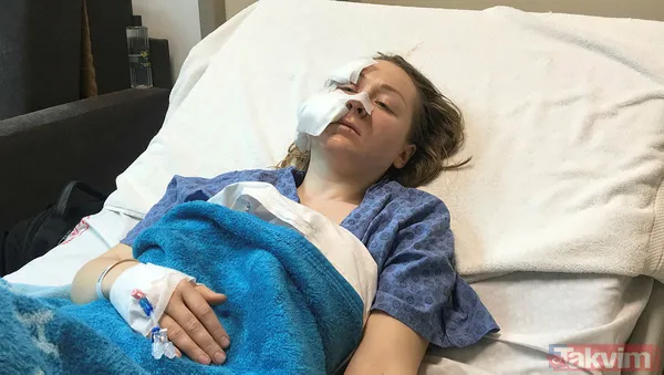 Genç kadına falçatalı dehşet! Boşanmak isteyen Ukraynalı eşi Anna Butim'in yüzünü parçaladı! - 12