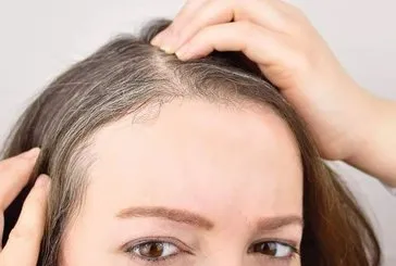 6 farklı yöntemle beyazlarınız artmadan mutlaka deneyin! 10 yaş gençleştiren doğal formül.... 13 günde beyaz saçlarınızı yok ediyor!