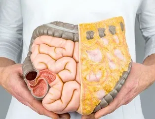 Hızlı kilo kaybı kolon kanserine işaret