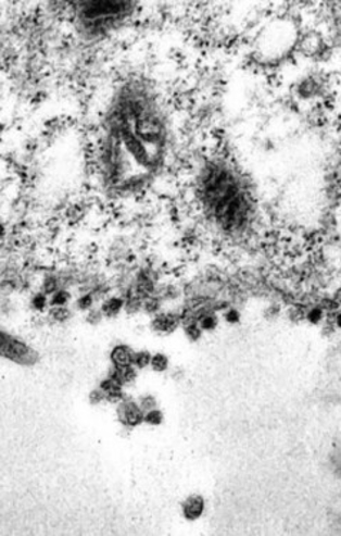 Son dakika: İşte koronavirüsün insan hücrelerine saldırdığı o an!