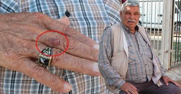 Kırkayak kabusu! Hastaneye gittiğinde ikinci bir şok yaşadı...