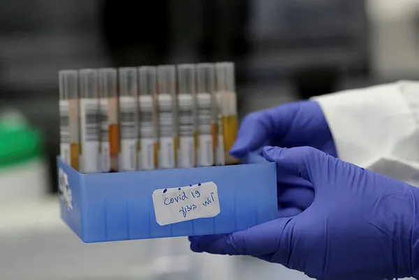 İşte koronavirüs bulaşma riskinin en çok olduğu yerler!-2