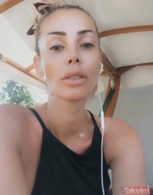 Burcu Özberk’te estetik var mı yok mu derken o görüntüler ortaya çıktı! Hayranları hayal kırıklığına uğradı gören şaşkına döndü - 44