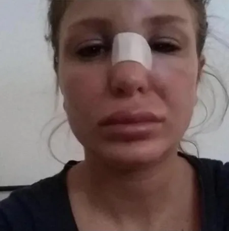 Berk Oktay'ın uygunsuz fotoğraflarını kimin sızdırdığı belli oldu-2