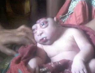 Annesi kucağına alınca şoka girdi! İşte dünyadaki en ilginç hastalıklar