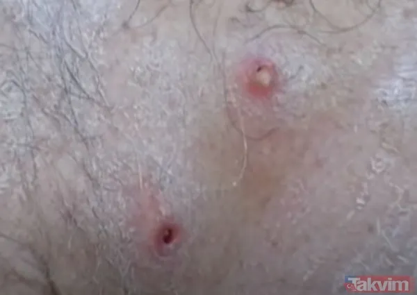 Karnındaki şişlik için gitti içinden çıkan doktorları bile şoke etti! Yer uzak değil Kayseri! 64 kilo girdi 55 kilo çıktı - 21