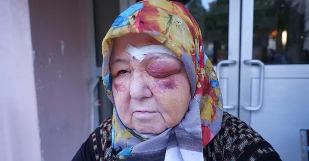 Edirne'de başıboş köpek dehşeti kamerada: Yaşlı kadının yüzü gözü tanınmaz halde