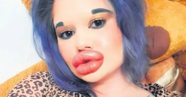 Sofya'da yaşayan Andrea Ivanova, estetik faciasının yüzü oldu!