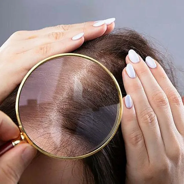 Kansızlık tehlike ’saç’ıyor