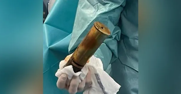 Fransa'da bir garip olay! Rektumundan Birinci Dünya Savaşı’ndan kalma Alman top mermisi çıktı