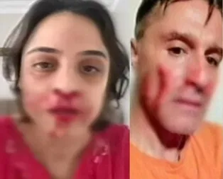 Kanlar içerisinde fotoğraf paylaşmıştı... Şok karar!