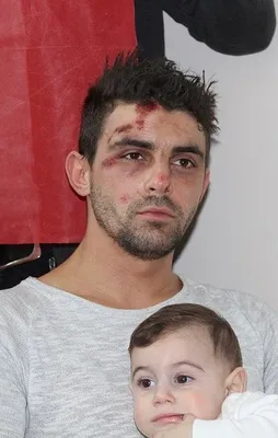 "Hollanda polisi bize köpeklerle saldırdı"