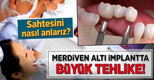 Merdiven altı implant tehlike saçıyor!
