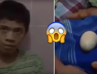 Doktorlar bile şokta! Endonezya'da yaşayan çocuk tavuk gibi yumurtluyor