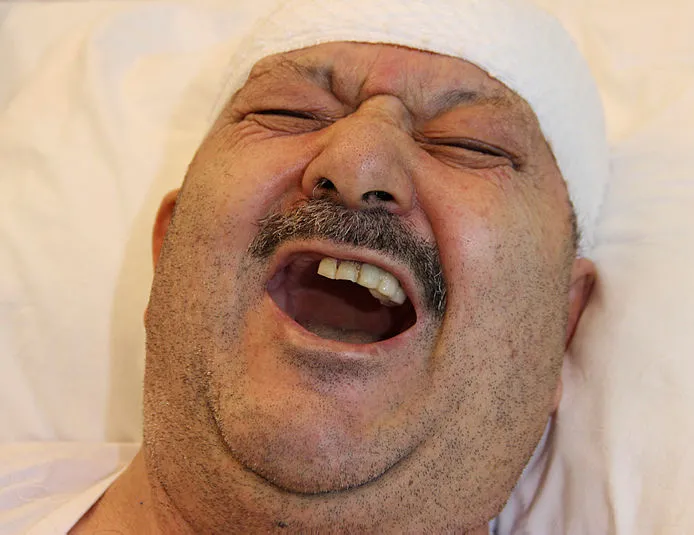 Diş ağrısı sandı 6 dişinden oldu! Gerçek bambaşka çıktı