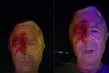 Görev başında yumruklu saldırı! Muhabiri kanlar içinde bıraktılar