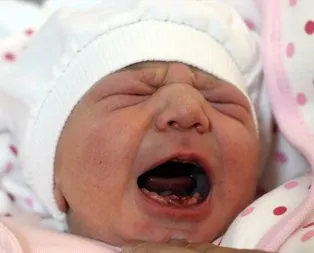 Amasya’da dokuz dişli bebek! Doktorlar şaştı kaldı