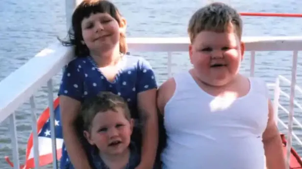 15 yaşındayken 320 kiloydu! Ameliyat olduktan sonra bambaşka biri oldu-2