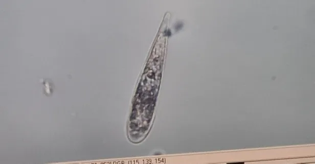 Müsilaj neden olur? İstanbul Üniversitesi ilk incelemesini tamamladı! Çarpıcı pandemi etkisi