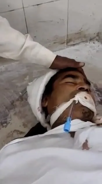 morgda-canlandi-kan-donduran-anlar-kamerada-iste-inanilmaz-anlar-1637758877230.jpg Morgda canlandı! Kan donduran anlar kamerada.... İşte inanılmaz anlar-4