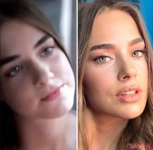 Bensu Soral "Hiç estetiğim yok kendimi güzel bulmuyorum" dedi ortalık birbirine girdi "Tabi biz de yedik" Yüzündeki değişim çok konuşulmuştu - 8