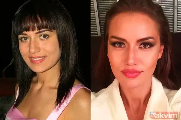 Safiye Soyman'ın son haline bakın "20 yıl geriye gittim genç kız gibi oldum" Seda Sayan'ın 'kobayı' Safiye estetikten sonra... - 31