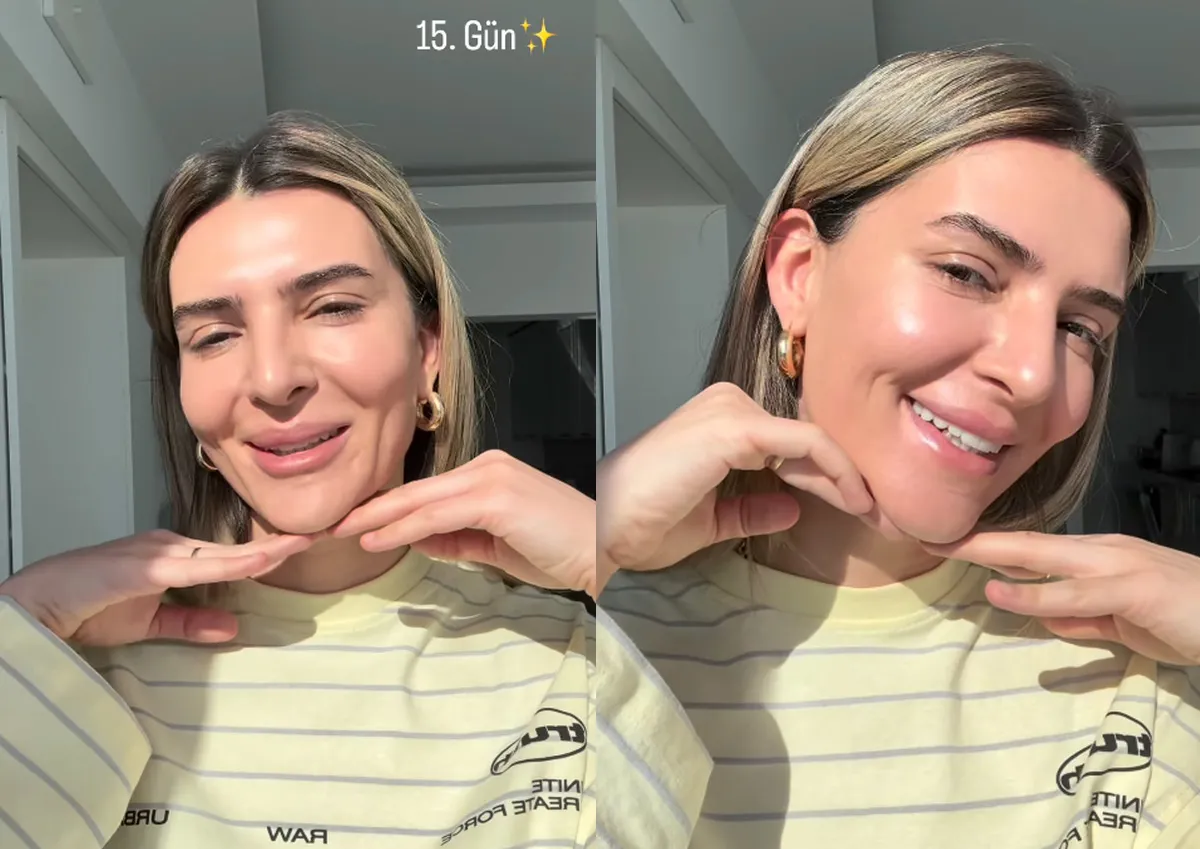 survivor-merve-aydinin-estetik-sonrasi-degisimi-gundem-oldu-1778839540649.jpg “15. gün” paylaşımı olay oldu! Survivor Merve Aydın’ın estetik sonrası değişimini görenler şaşkına döndü-5