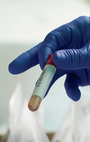 Son dakika: Koronavirüsün ilacı bulundu mu? Korona (Covid-19) ilacı 7 ülkede denemeye alındı