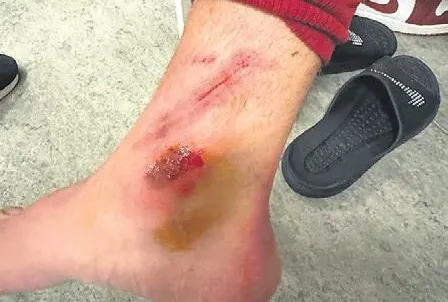 Barış Alper isyanı!