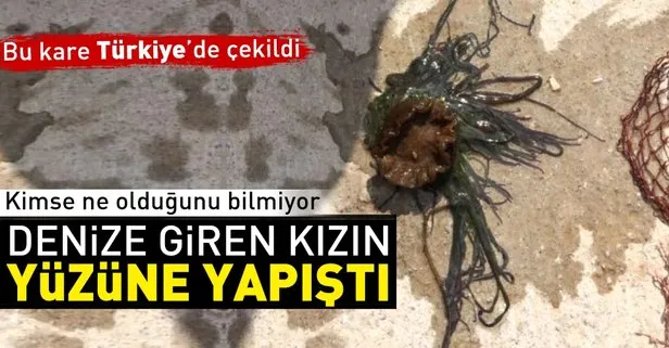 Çanakkalede denize giren kızın yüzüne yapıştı
