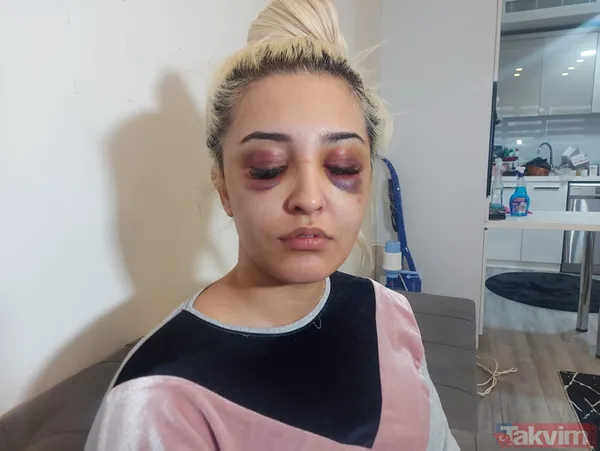 Eski sevgilisine dehşeti yaşattı: Ayrılmayı kabul etmedi 3 saat boyunca darp ederek tanınmaz hale getirdi! - 1