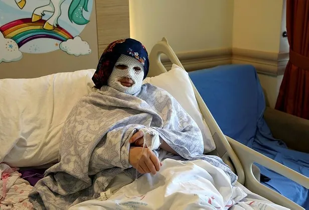 Erzurum'da korkunç olay! Patlayan düdüklü tencere yüzünde ve vücudunda derin yanıklar oluşturdu-1