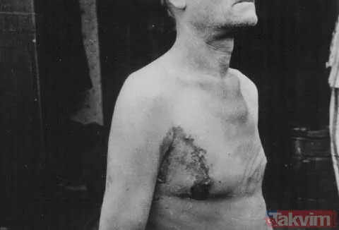 Benzer Şekilde, Yüksek İrtifa Deneyleri De Dachau'da Gerçekleştirildi. Uçak Mürettebatının Oksijensiz Yaşayabileceği Maksimum Rakımı Belirlemek Amacıyla...