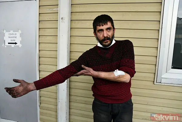 Gaziantep'te ikinci pitbull vakası! Saldırıya uğrayan talihsiz adam konuştu: "Kendimi kurtaramasam parçalayıp öldürürdü" - 6