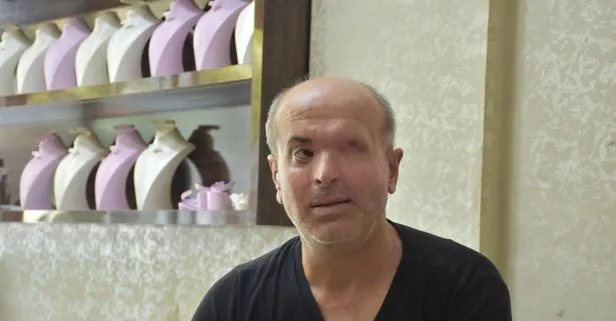 İzmir Buca’da 30 yıllık kuyumcu kezzaplı saldırı sonucu sol gözünü kaybetti