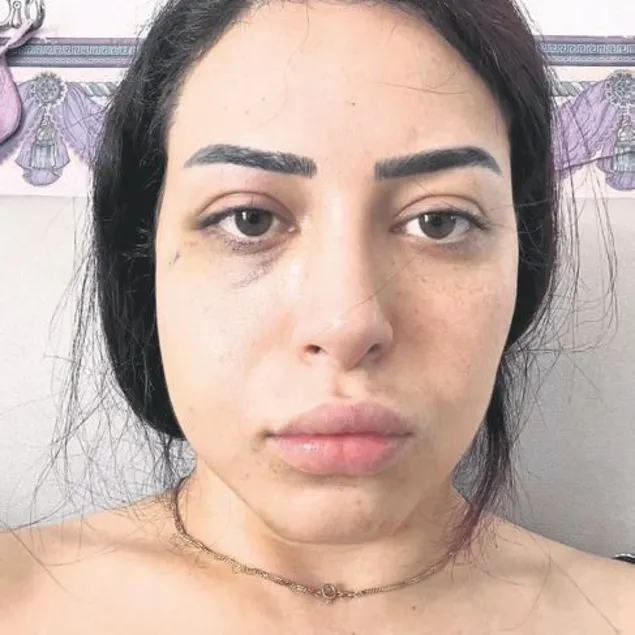 Asya’ya küstah saldırı