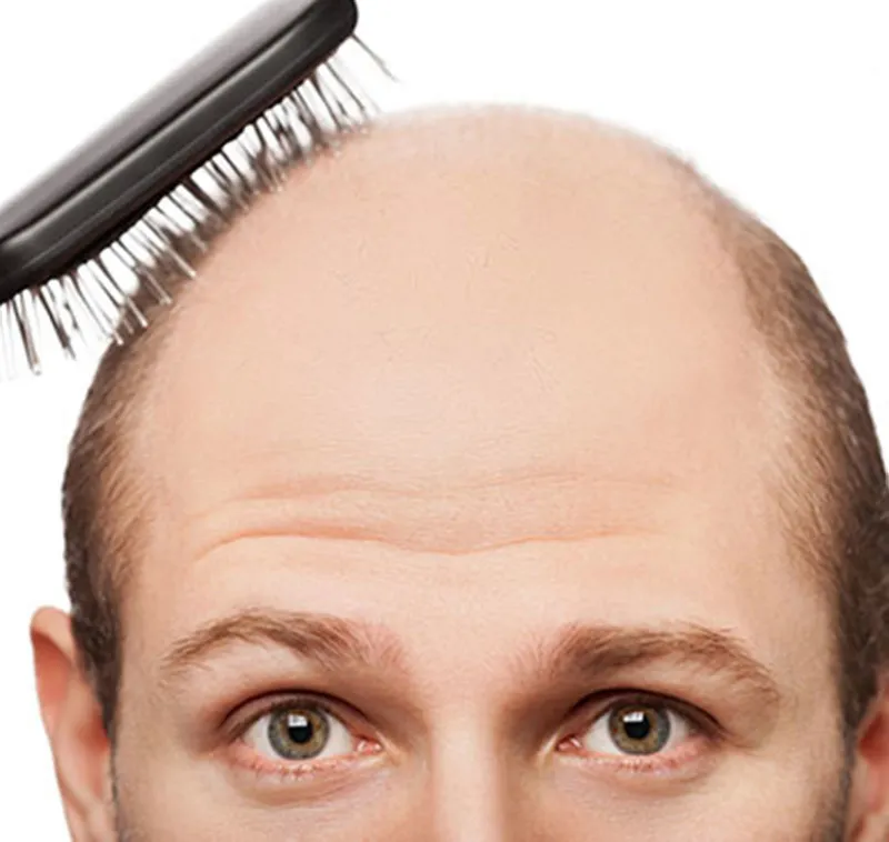 Sandal ağacı kelliğin ilacı mı? Sandal ağacı yağının faydaları - 2