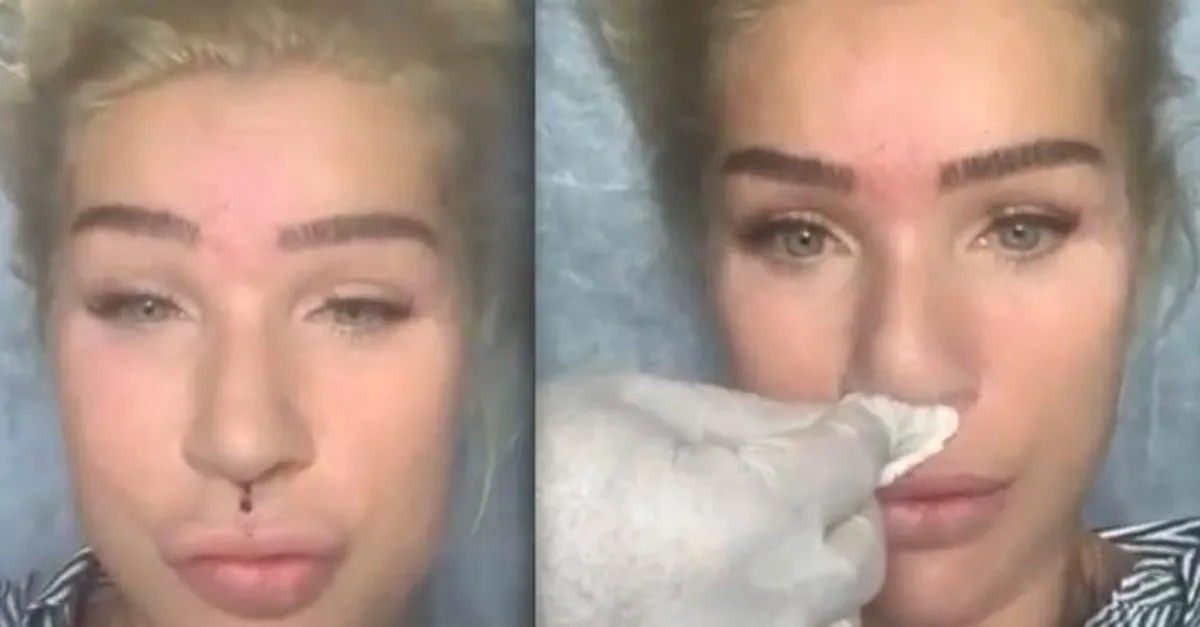 seda sayan yine canli yayinda estetik yaptirdi 57 yasindaki seda sayan yine olay yaratti galeri takvim