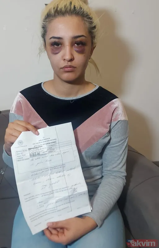 Eski sevgilisine dehşeti yaşattı: Ayrılmayı kabul etmedi 3 saat boyunca darp ederek tanınmaz hale getirdi! - 9